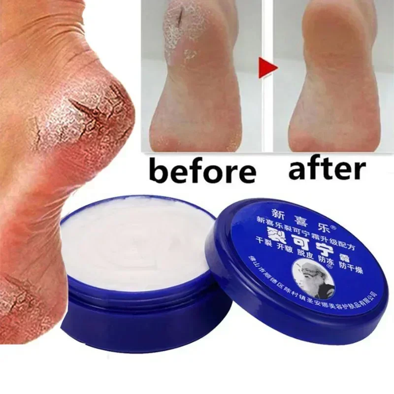 Herbal Anti Crack Foot Cream, Óleo anti-secagem, Reparação do calcanhar rachado, Remover a pele ruim, Máscara de cuidados com os pés da mão