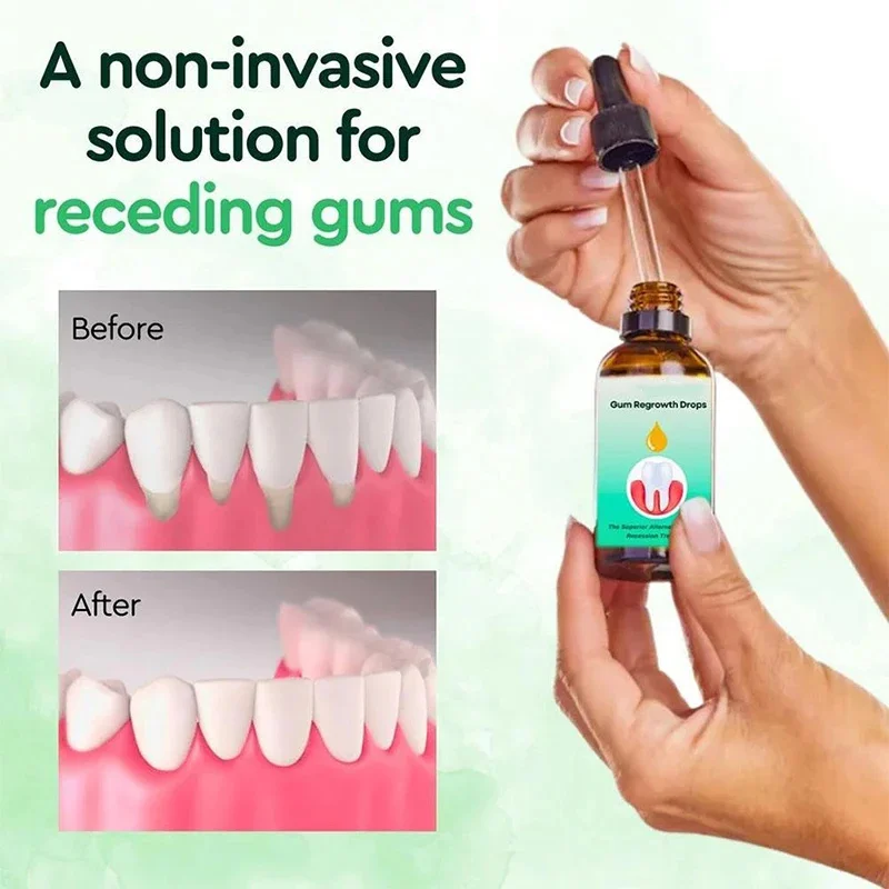 Suero de reparación rápida de encías, gotas para eliminar las manchas de los dientes, alivia la hinchazón Gingival, blanquea las encías, higiene Periodontal, cuidado bucal