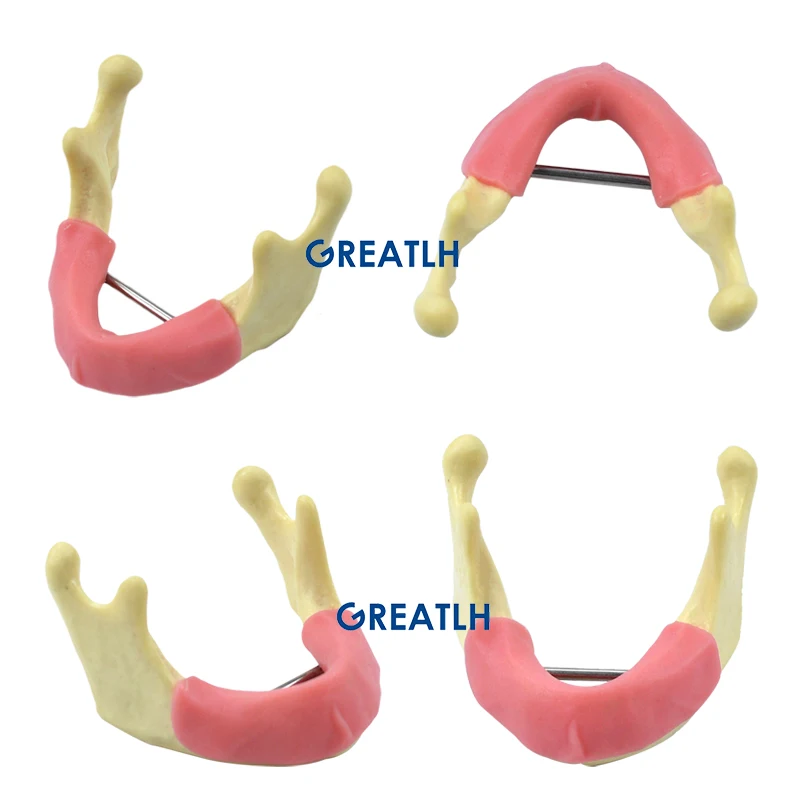 72types Dental Teeth Model Implant with Removable Training Demonstration Model Mandible Tissue Anatomical Model Dentist Material
