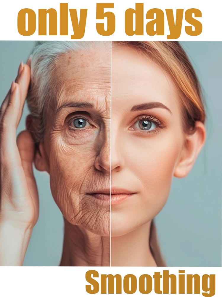 

No aging marks presenting a healthy glow