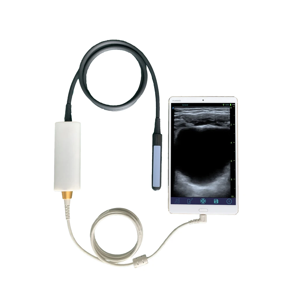 

MY-A010A-E portable mini USB ultrasound Veterinary Vet Rectal Linear USB probe ultrasound for animal use