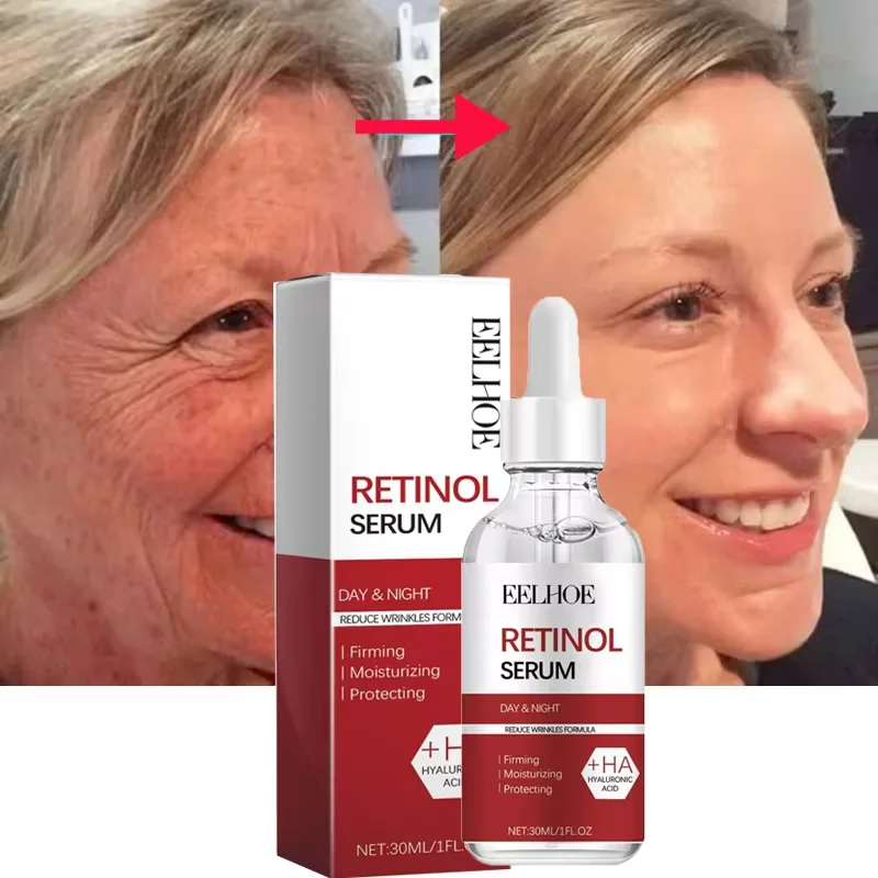 Retinol-Removedor de Rugas Facial Serum Set, Firming Instantâneo, Lift Anti-Envelhecimento Creme, Fade Fine Lines, Clareamento, Hidratante, Cuidados com a pele