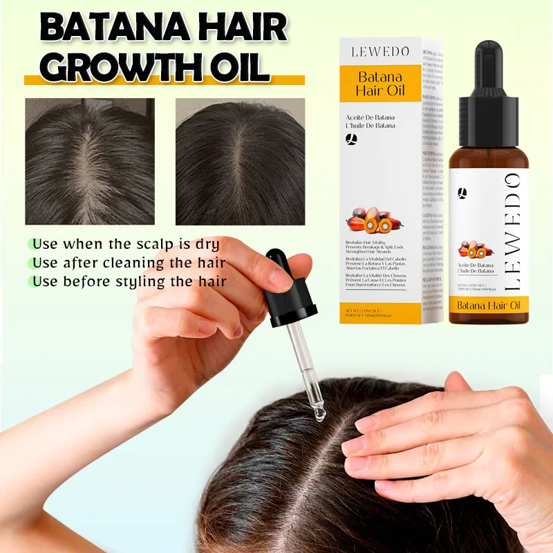 

Batana Oil Hair Growth Essential Regrowth Strengthens Pure Natural Hair Growth Batana Oil Hair Nourishes Scalp Care Anti Loss
