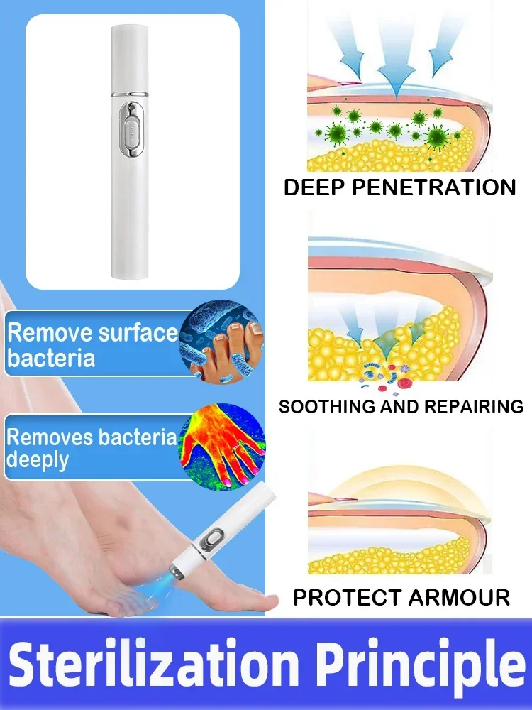 Produto a laser para resolver problemas de unhas