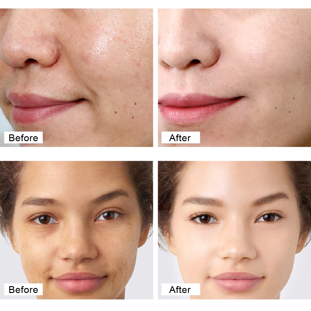 LEBENDIGE GLAMOUR Retinol Gesicht Creme Anti-Aging Entfernen Falten Straffende Hebe Bleaching Aufhellung Feuchtigkeits Hautpflege 5 stücke