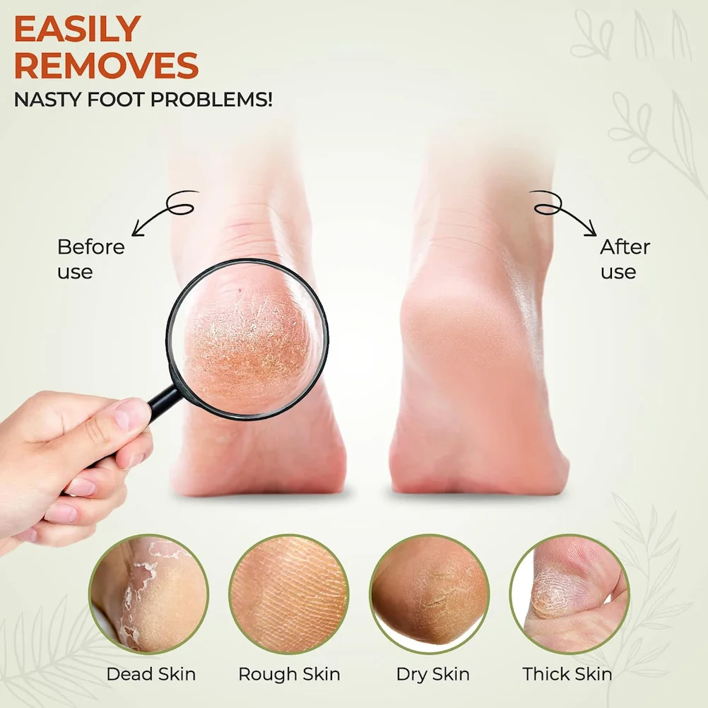 1/2Pc 足カルスリムーバー足ファイルポータブル両面ペディキュア足ファイルサンディングハードスキンリムーバー角質除去ペディキュアツール