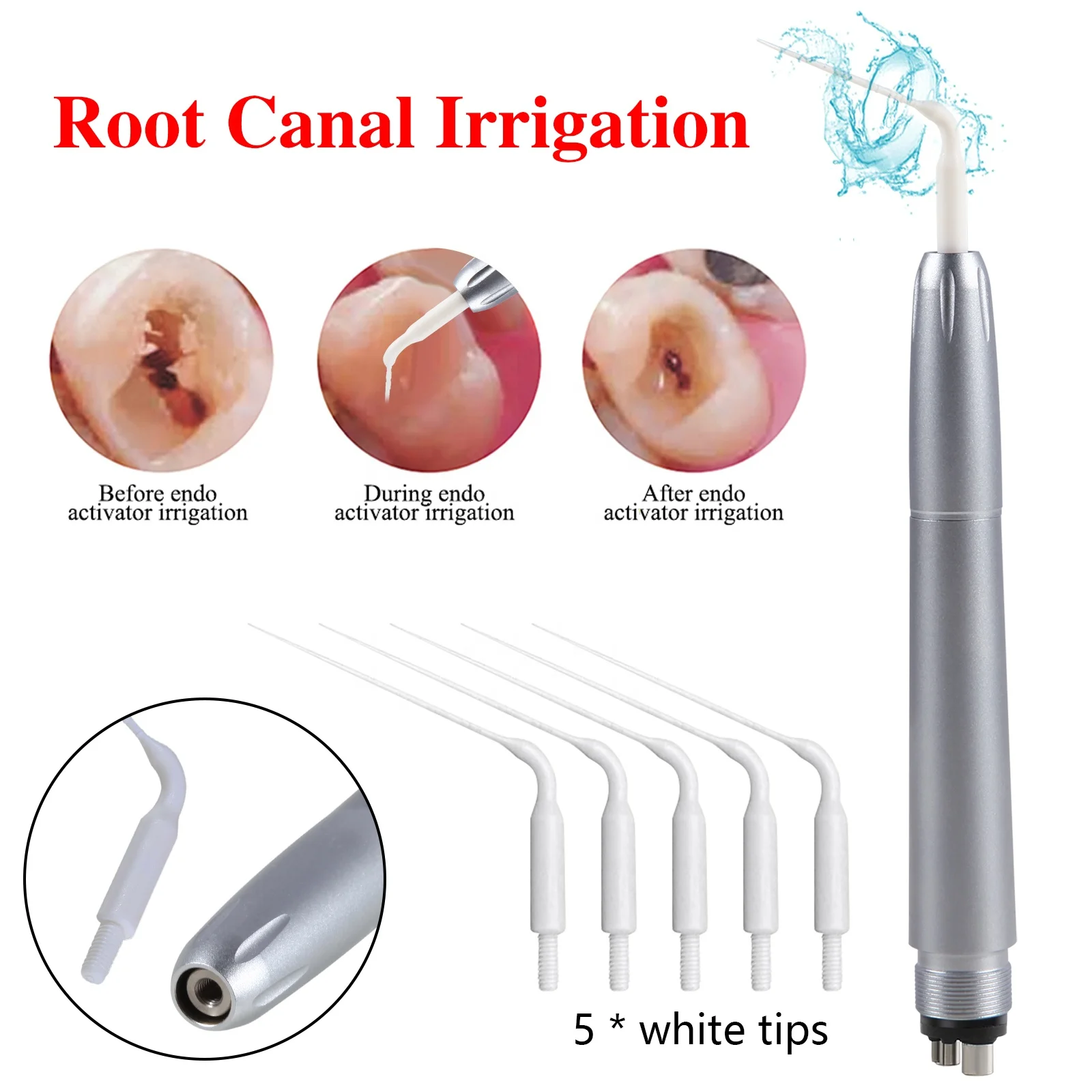 Hot Selling! den tal Air Scaler Endo Ultra Activator Irrigator Root Canal Handpiece 4 Hole+5 K-a-v-o Endo Irrigation Tips