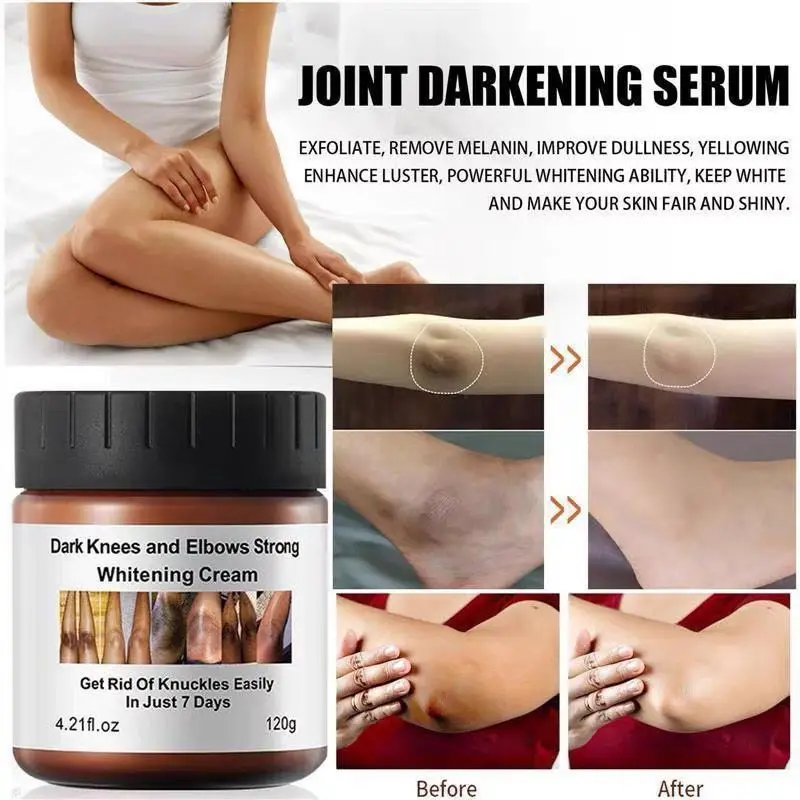 Dark Knuckles Fast Brighten Cream Elbows Hand Knuckle Brightening Serum Knee Black Skin Quickly Lighten Stains Remover Products