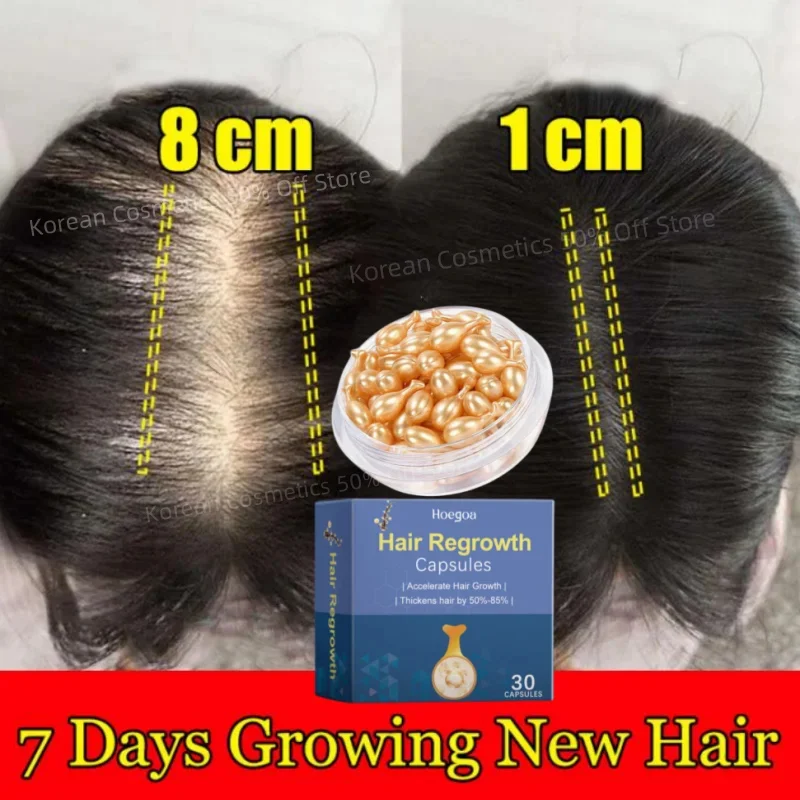 

Hair Growth Serum 7 Days Fast Regrowth Essential Capsule Anti Hair loss Baldness Repair Damaged Scalp Treatment For Women Men