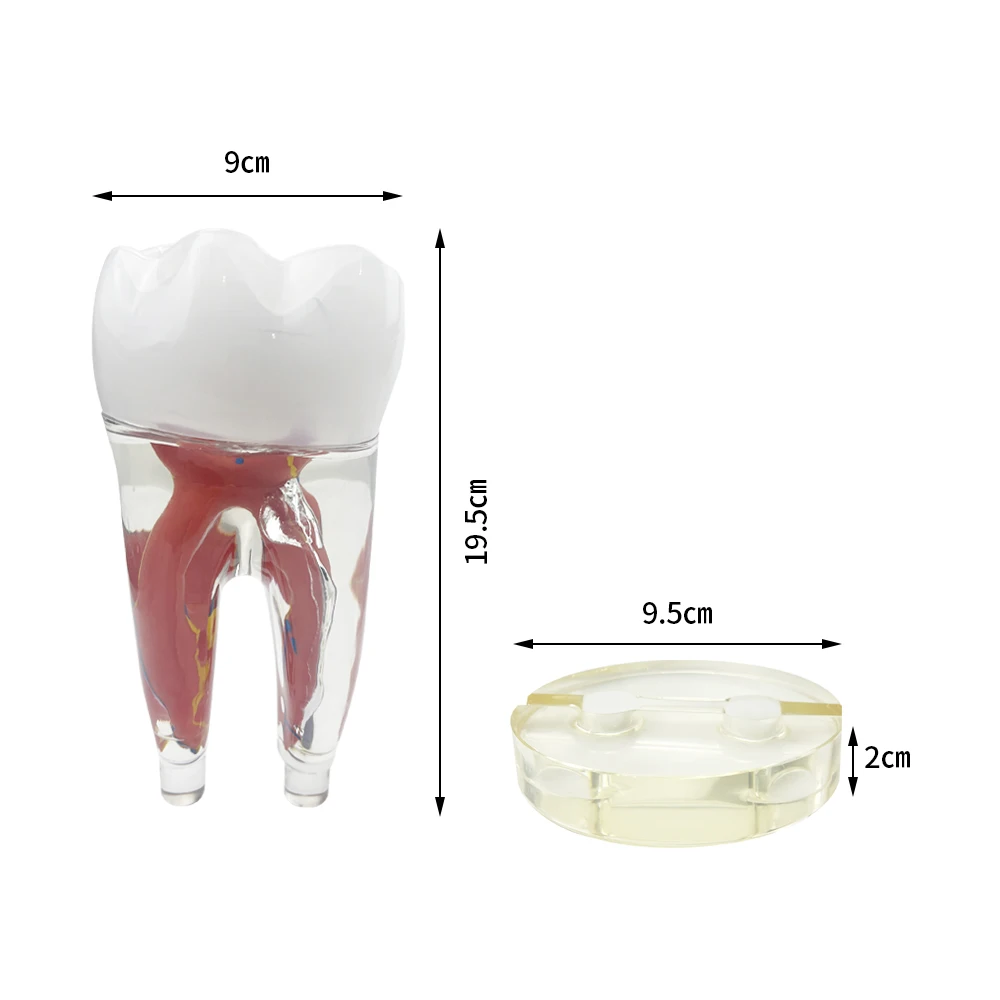 10 razy endodontyczna Model dentystyczny duża przezroczysta miazga zębowa i Model zębów nerwowe odłączalne modele do nauczania nauki