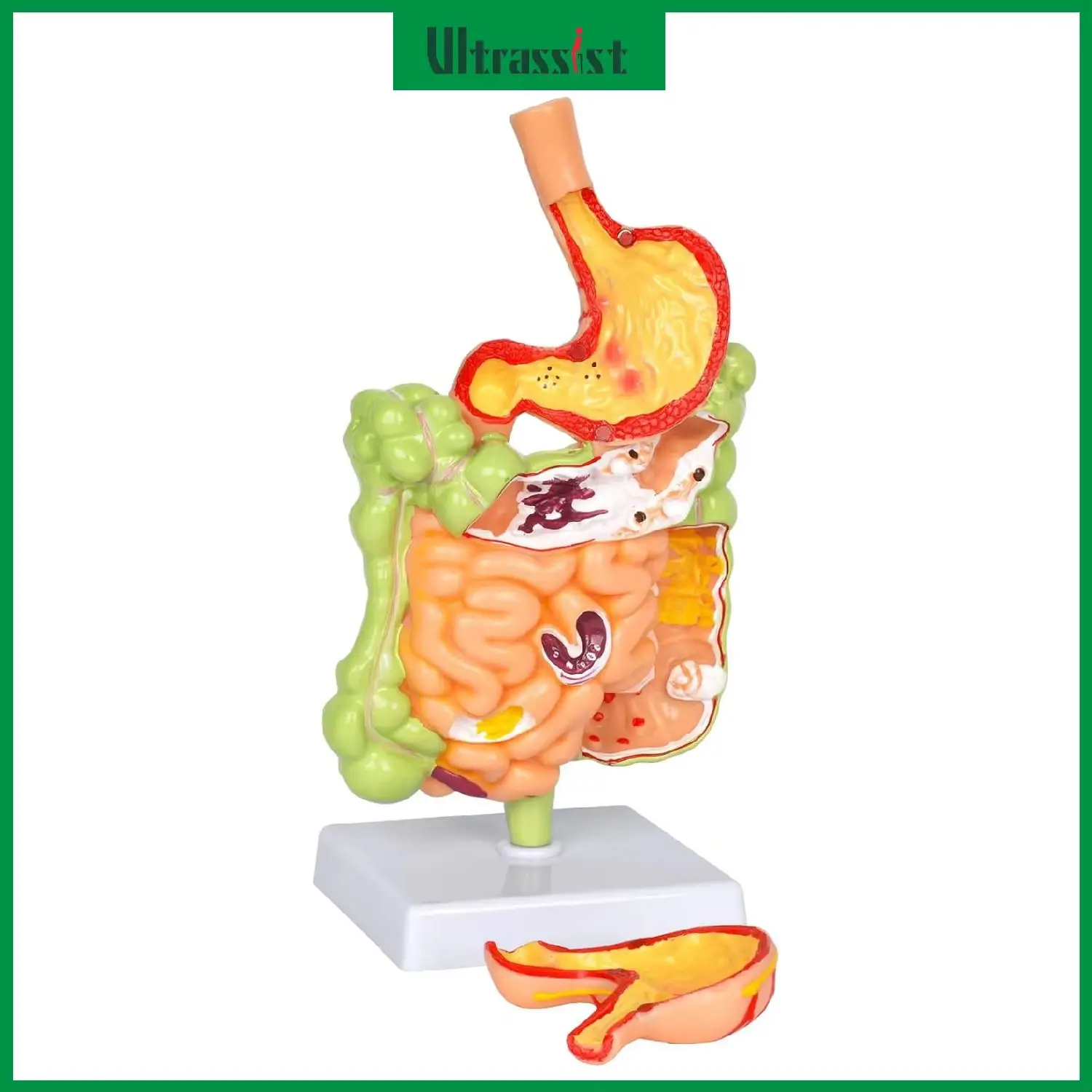 Ultrassist Human Stomach Anatomy Model Pathological Large Small Intestine Anatomical Removerable PVC for Medical Student Class