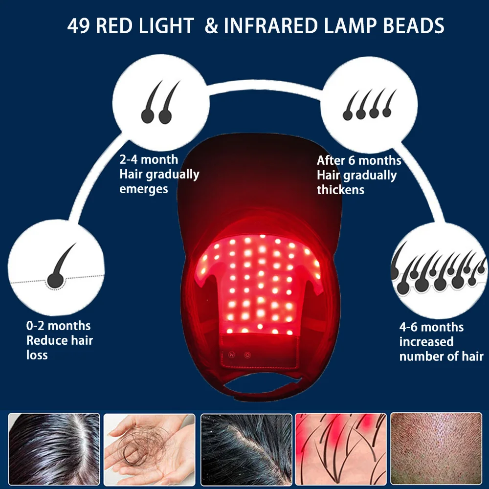 Estherqueen หมวก Topi lampu LED สีแดงหลอดไฟอินฟาเรดและสีแดงอุปกรณ์ปลูกผมร่วงพร้อมแบตเตอรี่