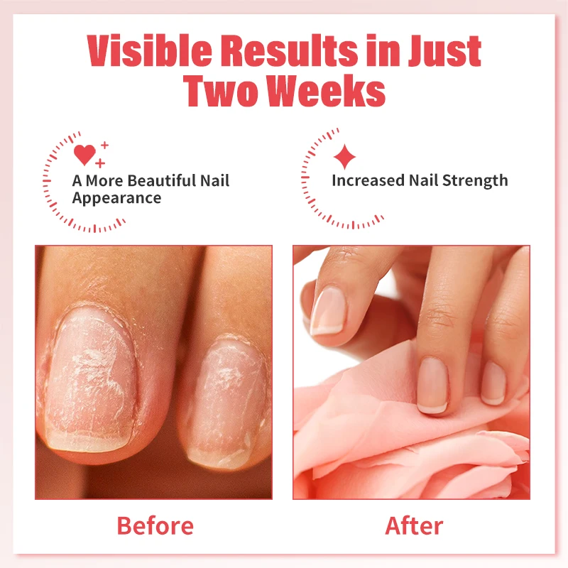 Olejek wzmacniający paznokcie: Lakier do paznokci utwardzający do leczenia uszkodzonych paznokci, naturalna naprawa keratynowa, zapobiega rozdarciom, pęknięciom i odpryskom.