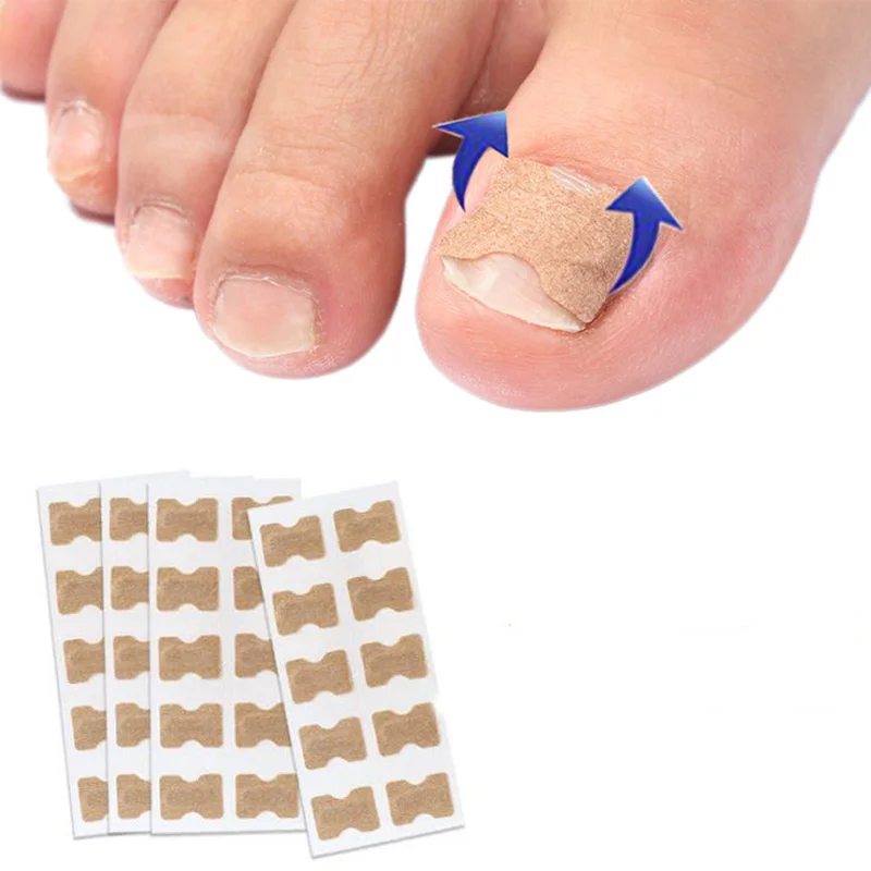 20-100Pcs Professional Ingrown Toenail Foot Corrector Stickers Elasticity Nail Care Pedicure Tools Health Care Protects Toe Nail