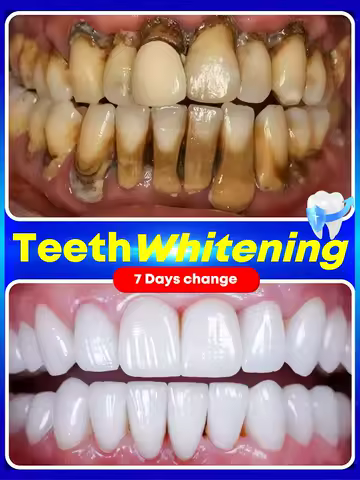 2025 New Technology Effectively Whitens Teeth and Cleansing Plaque Mineral Powder