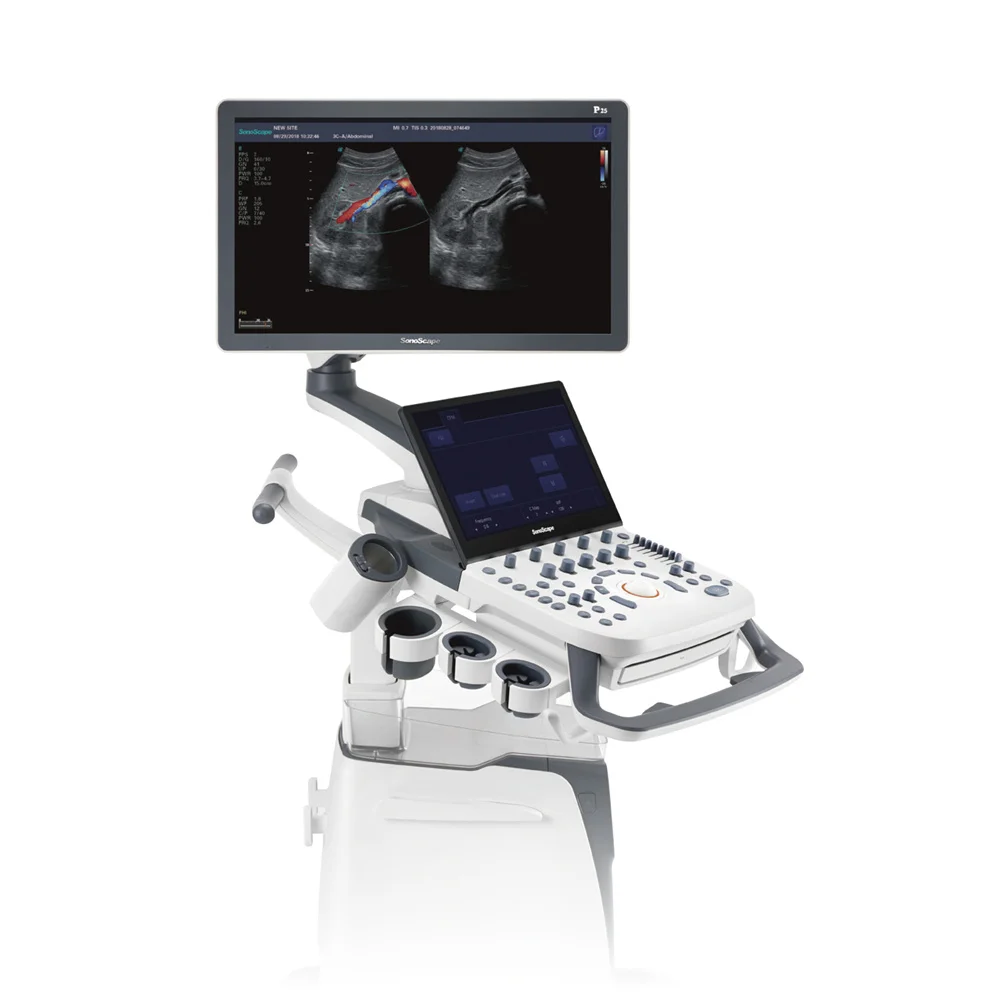 Medical Trolley Digital 3D 4D color doppler mobile medical ultrasound machine price