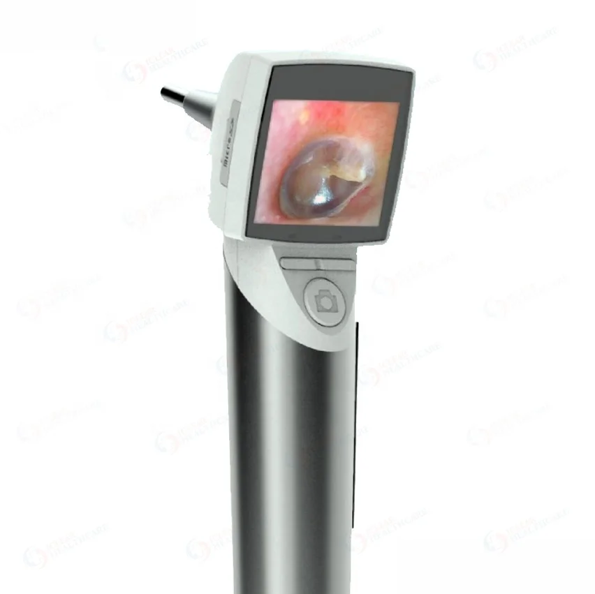 Wireless HD Handheld ENT Video Endoscope Digital Otoscope