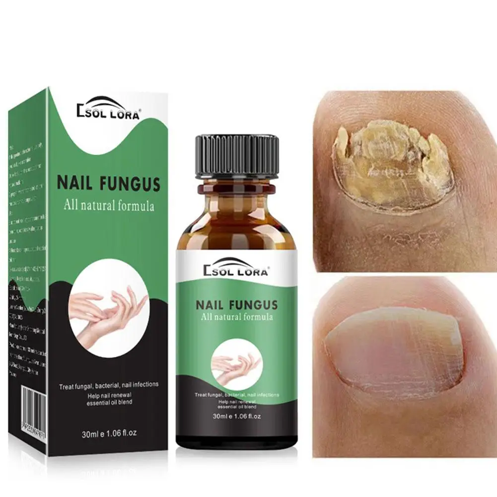 Sérum de réparation des ongles décolorés endommagés aux scanner, essence de bain renforcée, solution rapide N64.Solution, anti-Bri, Y2H6