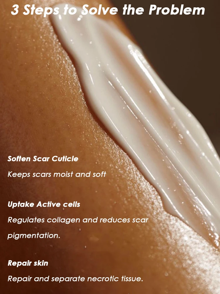 Herbal Scar Care Cream for You 30g