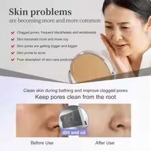 ANLAN Skin Scrubber