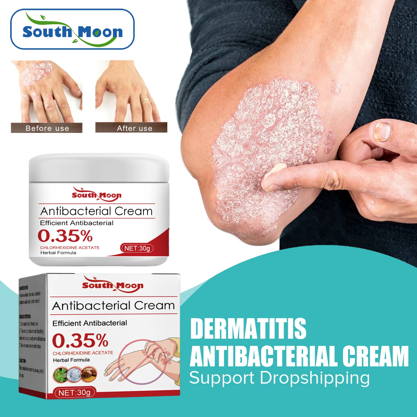 

Psoriasis Antibacterial Ointment Anti-Itch Eczema Red Rash Urticaria Blister Treatment Desquamation Dermatitis Relief Cream 30g