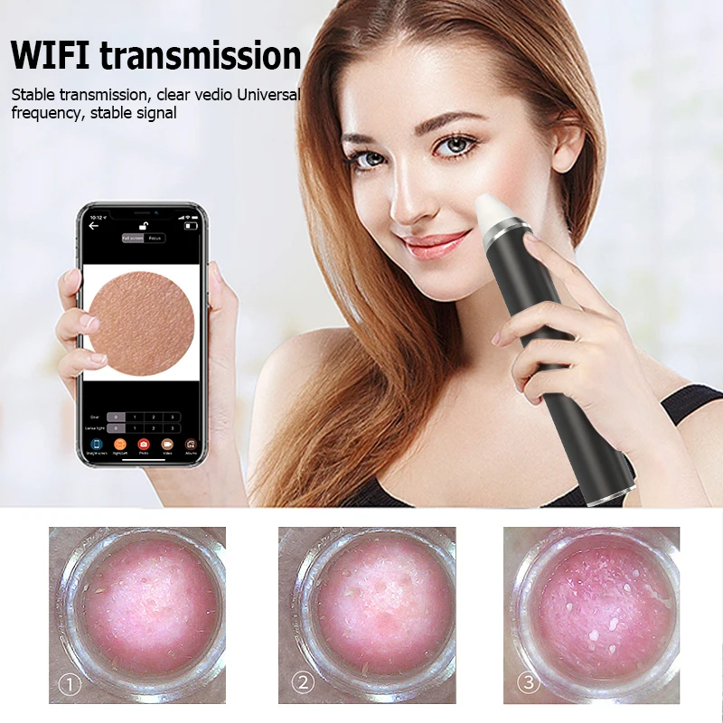 Best Selling Electric Face Acne Pimple Care Blackhead Remover Vacuum