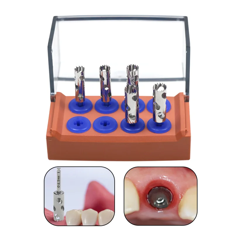 

Набор стоматологических трапециевидных боров для имплантации, кольцевые фрезы для имплантатов, боры для резки кости, стоматологический инструмент из нержавеющей стали