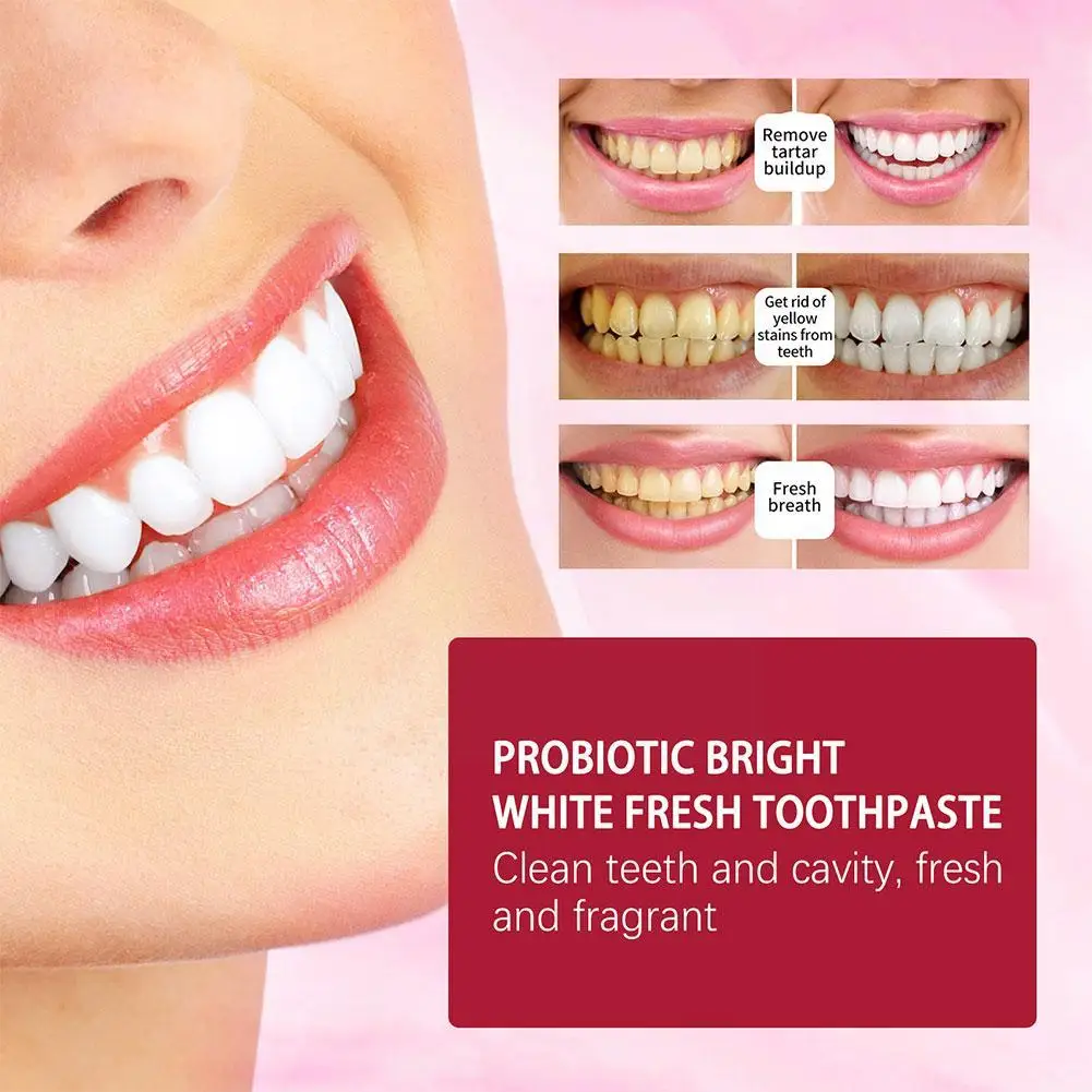 EELHOE SP-4 Probiotic Whitening Shark Toothpaste 120g Teeth Breath Toothpaste Oral Plaque Toothpaste Whitening Prevents Fresh