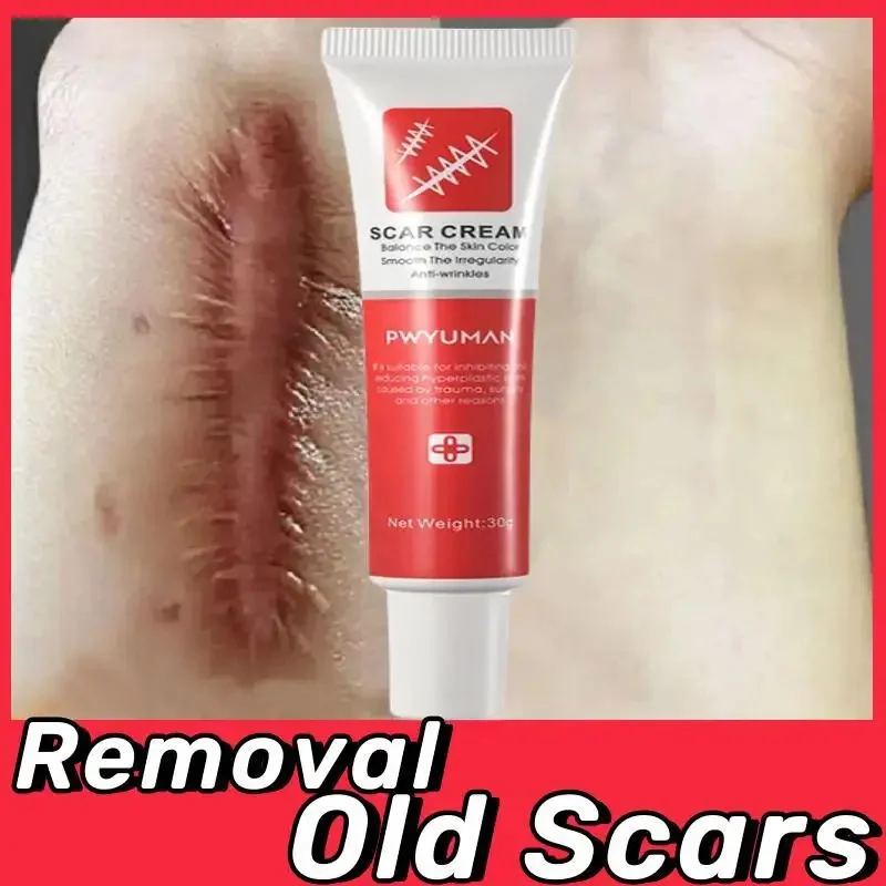 Powerful Scar Removal Cream Heal Old Deep Keloid Scar Treat Stretch Marks Burn Surgical Acne Spot Repair Whitening Skin 1/3/5pcs