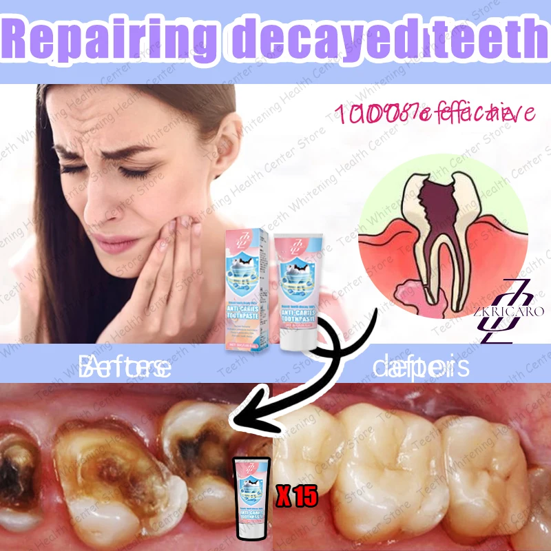 99% of people repurchase, hot selling, repair tooth decay