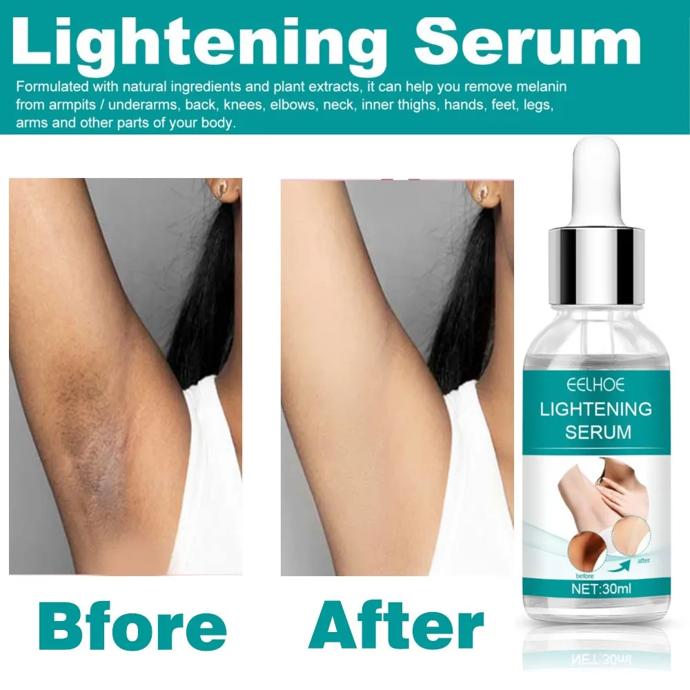 Body Whiten Serum Private Part Underarm Dark Skin Bleach Knee Thigh Inner Dull Melanin Brighten Moisturize Skin Care Body Lotion