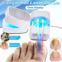 Fungal Nail Laser Device Repair Fast Toenail Nail Fungus Feet Treatment Fingernail Onychomycosis with Mushrooms Nails Foot Care