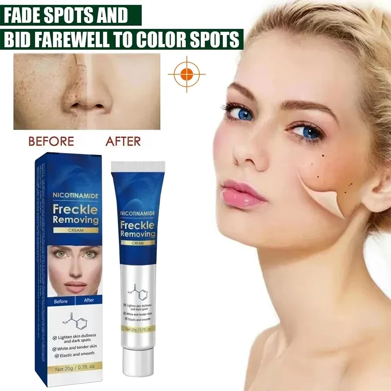 Facial Whitening Cream Removes Melanin Age Spots And Freckles Reduces Dullness Moisturizes Brightens Facial Care