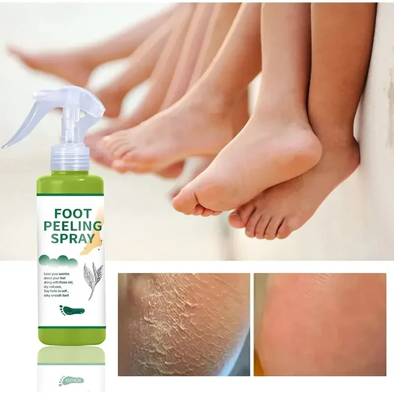 Green Tea Foot Care Foot Peeling Spray With Natural Green Tea Essence Whiten Feet Scrubber Exfoliator Dead Skin Remover 100ml