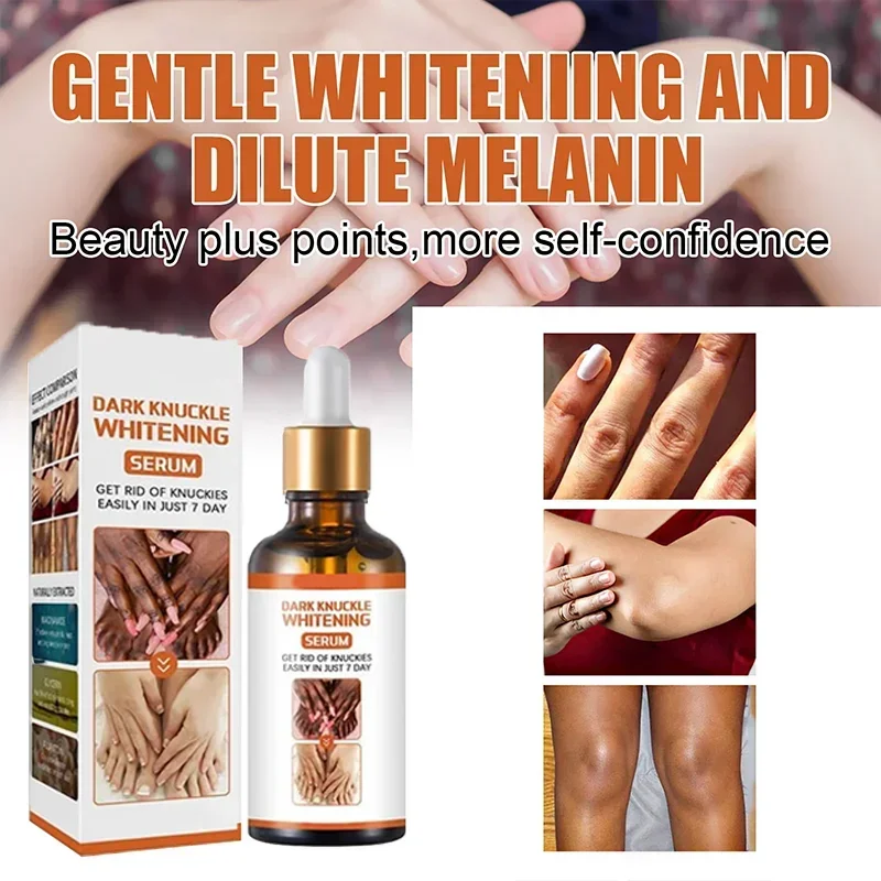 Skin Whitening Cream Private Parts Underarm Bleaching Serum Whiten Butt Knee Brighten Inner Thigh Arm Body Remove Dark Melanin