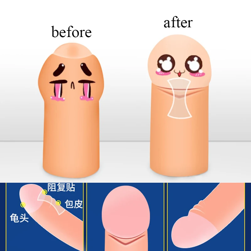 48PCS Foreskin Correction Cock Ring Foreskin Repair Stickers Penis Sex Toys For Men Delay Ejaculation Male Chastity Sex Shop