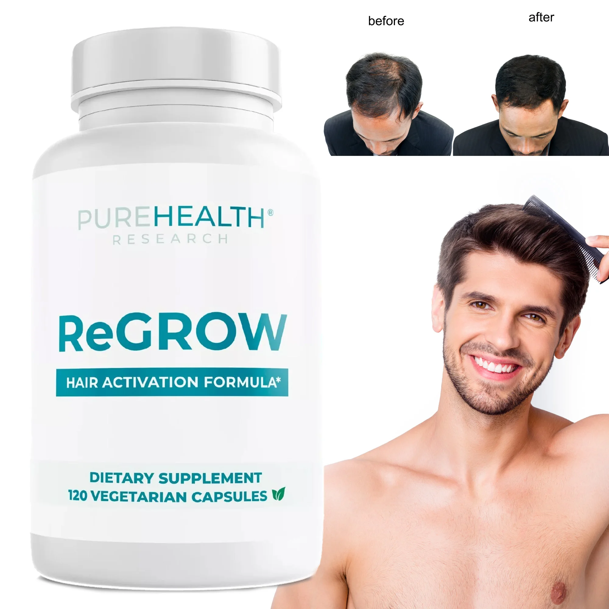 

ReGrow - Hair Growth Vitamins To Help Promote Hair Growth and Increase Hair Density, Suitable for Both Men and Women