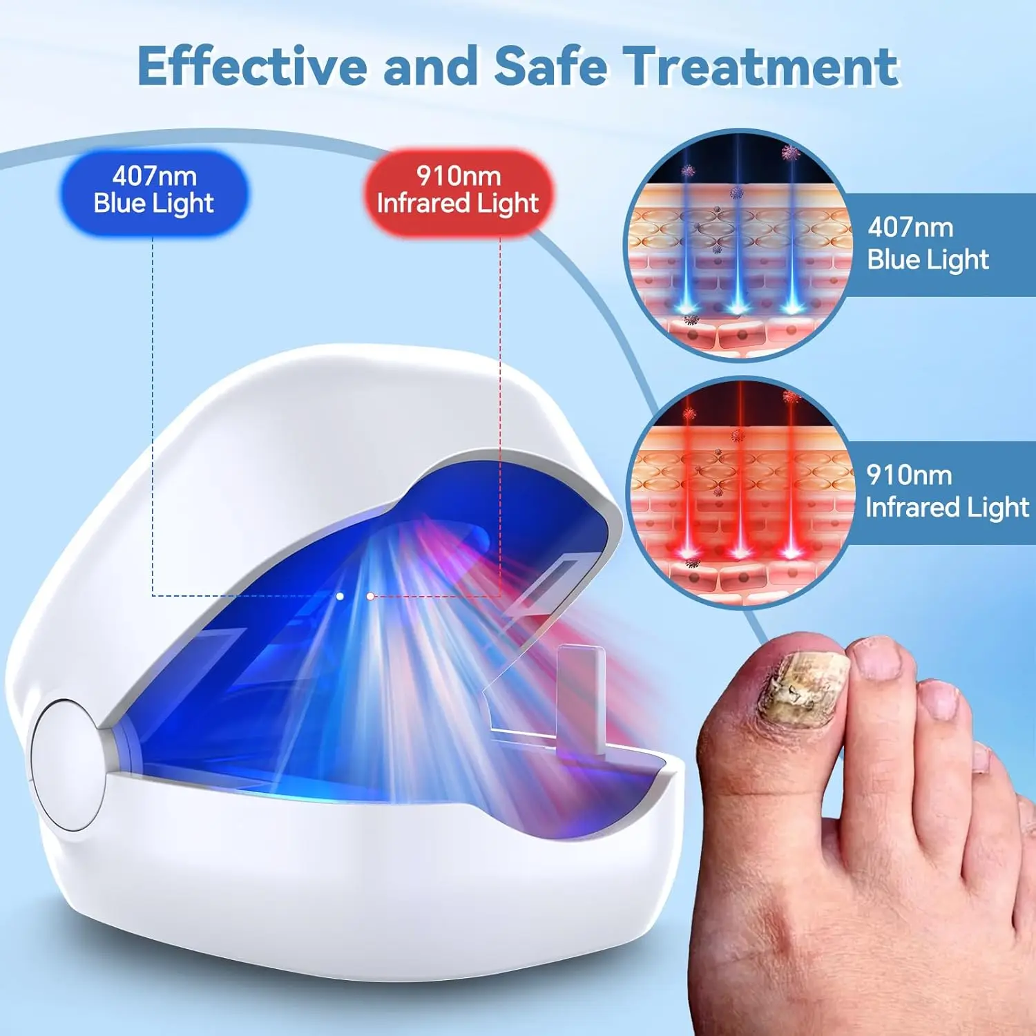 Fungal Nail Laser Device Repair Toenail Fingernail Treatment Anti Fungus Infection Paronychia Onychomycosis Ingrown Toenail