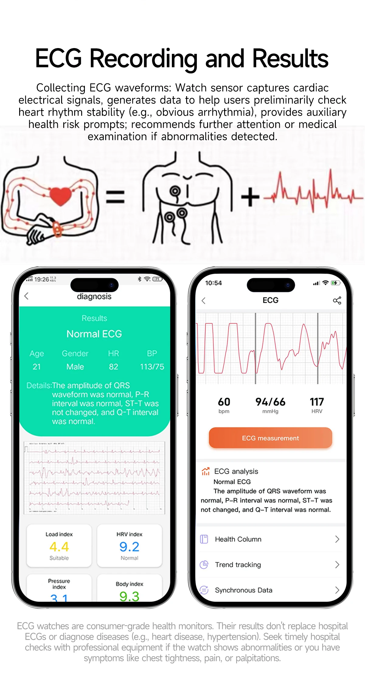 Smartwatch Avec Ecg Et Analyse De Santé Par Laser Dual-probe_voghion.com