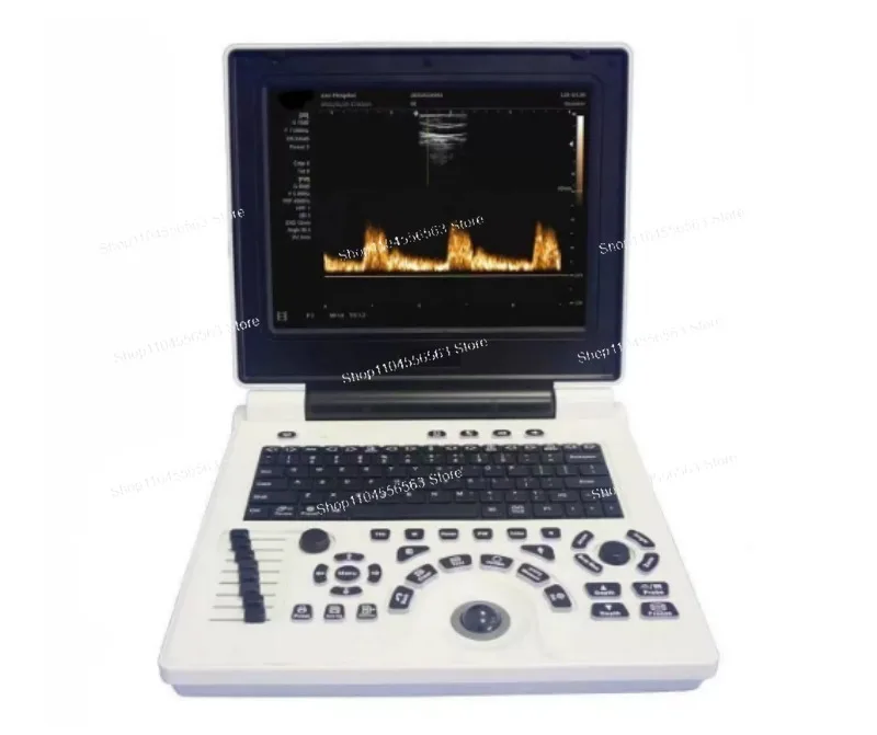 Portable 12 Inch Veterinary Ultrasound Scanner, Black White Doppler for Farm Animals Pregnancy Testing, Convex Probe with USB