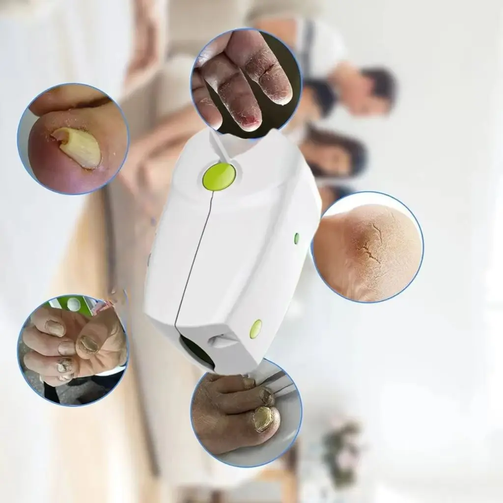 

Perfect Gift Laser Nail Care Set - Treat Fungal Nails for Parents/Grandparents, Includes Storage Pouch