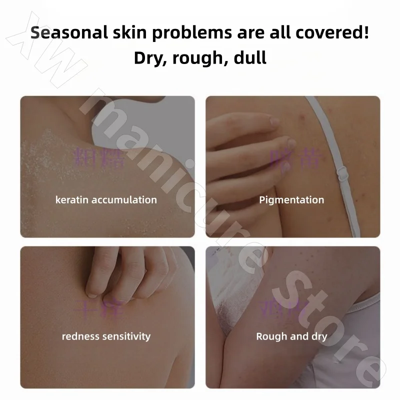 لوشن الجسم النياسيناميد لتفتيح الجسم بالكامل، لوشن الجسم المرطب يحسن البشرة الجافة والظلام ويقلل الميلانين 300 مل