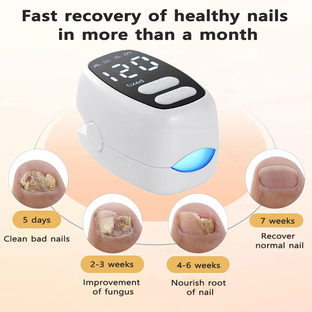 Dispositivo de hongos Lase r para uñas de los pies múltiples, onicomicosis, reparación de uñas, equipo antifúngico Lase r