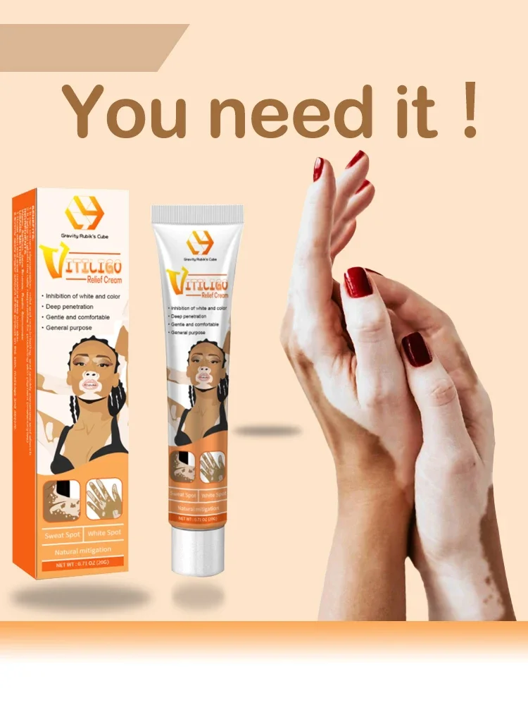 

Vitiligo Treatment Cream Melanin Growth Ointment Fast Remove White Spot