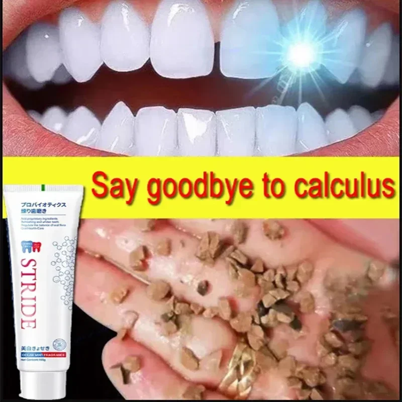 Pasta de dientes blanqueadora para eliminar el cálculo Dental, blanqueamiento Dental, prevención de brillo, eliminación de la Periodontitis, mal aliento, cuidado de limpieza Dental