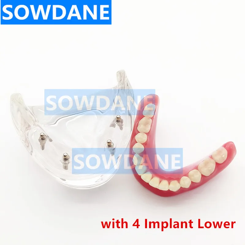 Dental Study Teaching Model Dental Impant Standard Model Removable Teeth ADULT Child TYPODONT Model  Dentist Communication Model