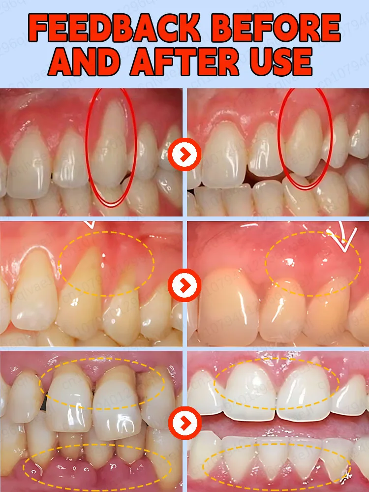 เอสเซนส์ป้องกันฟันผุ ฟื้นฟูเคลือบฟัน ซ่อมแซมฟัน เสริมสร้างความแข็งแรง ซ่อมแซมฟันผุ