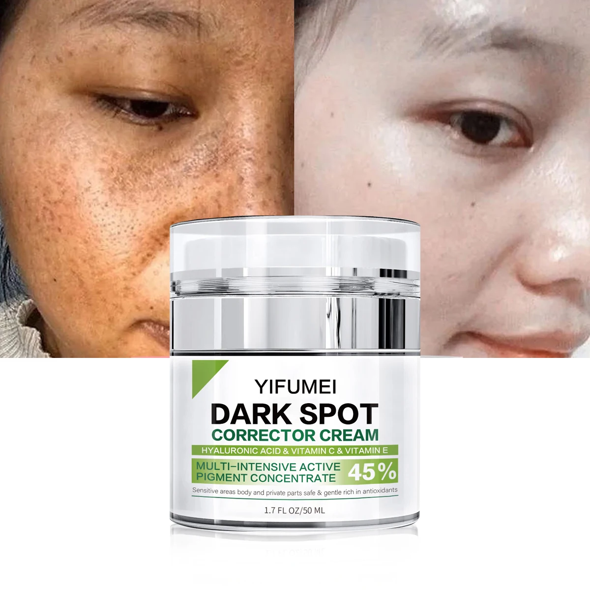 

Removal Sun Spot and Freckle Moisturizer Facial Cream Melasma Corrector Anti Age Dark Spot Remover Face Care