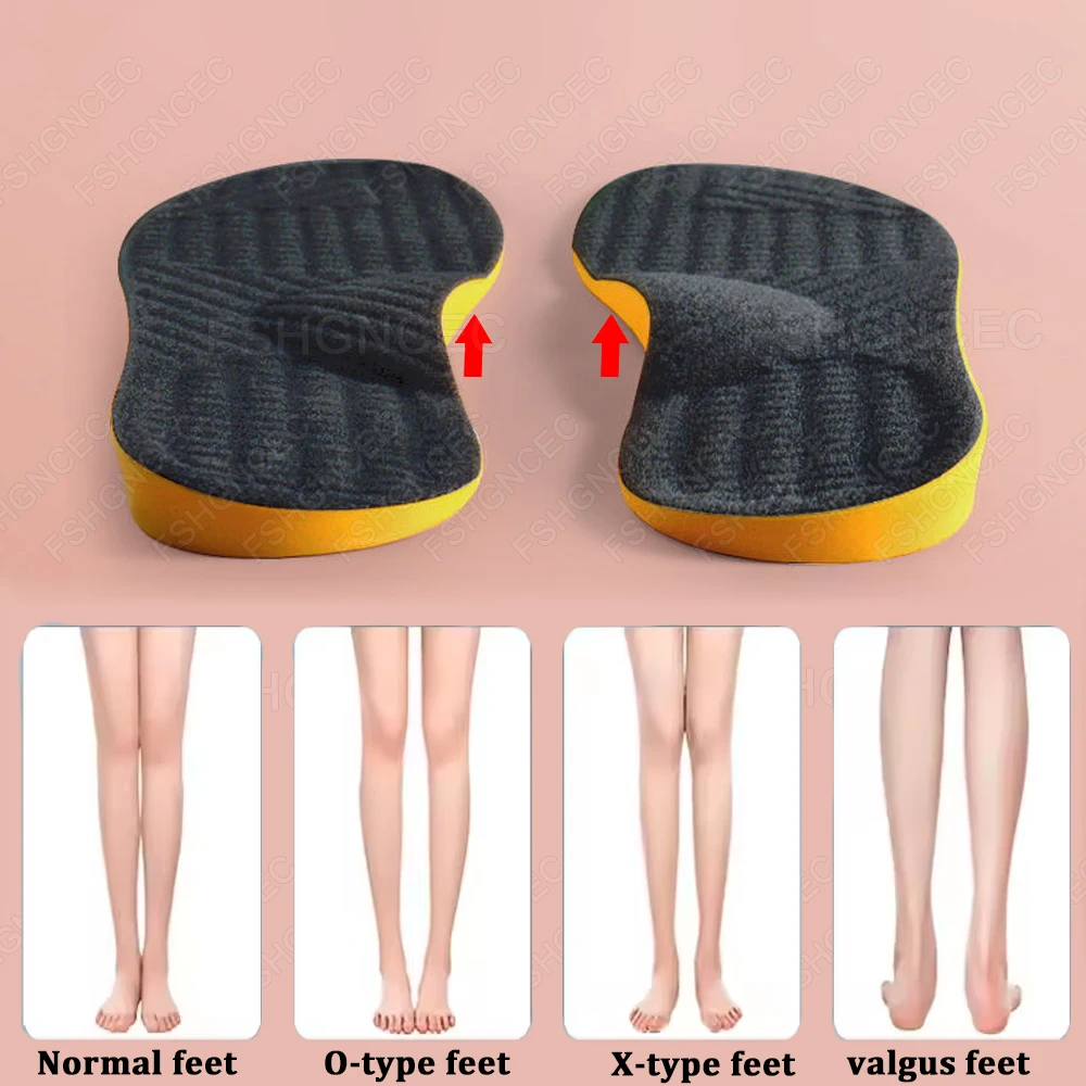 

2Pcs Orthopedic Insoles Man Woman Flat Foot Arch Support Orthotic Insole X/O Type Legs Valgus Feet Correction Sports Shoe Pad