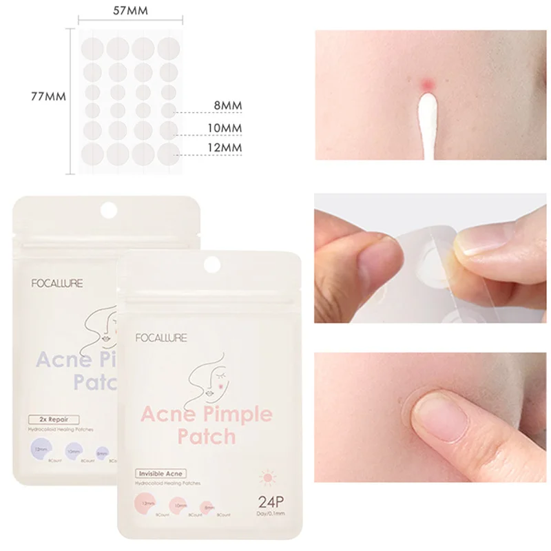 Parches adhesivos para el acné, tratamiento para el acné, herramienta para eliminar granos, manchas, mascarilla Facial, cuidado de la piel, impermeable, 22 parches, TSLM1